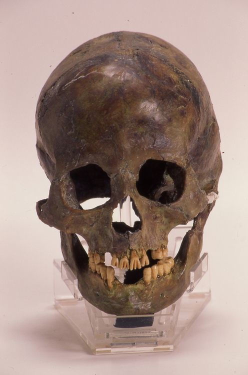 叉状研歯のある頭骨（渥美郷土資料館展示）